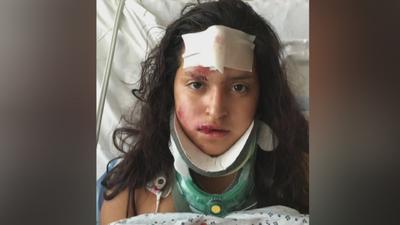Hispana herida en Charlottesville con fractura de cráneo
