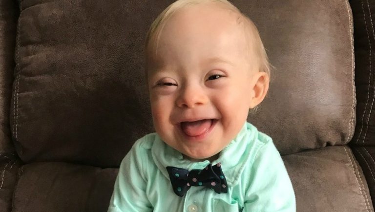 Bebé con síndrome de down, la nueva imagen de Gerber