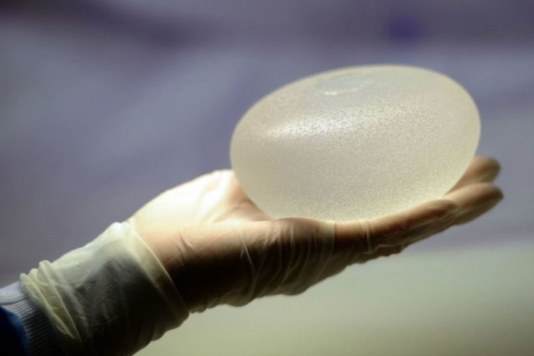 FDA solicita retiro mundial de implantes mamarios