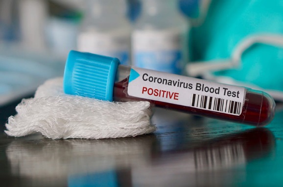 OMS probará primeras vacunas COVID-19 en 4-5 meses