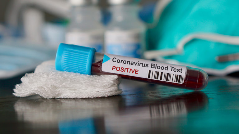 Nuevo presunto caso de coronavirus en SC