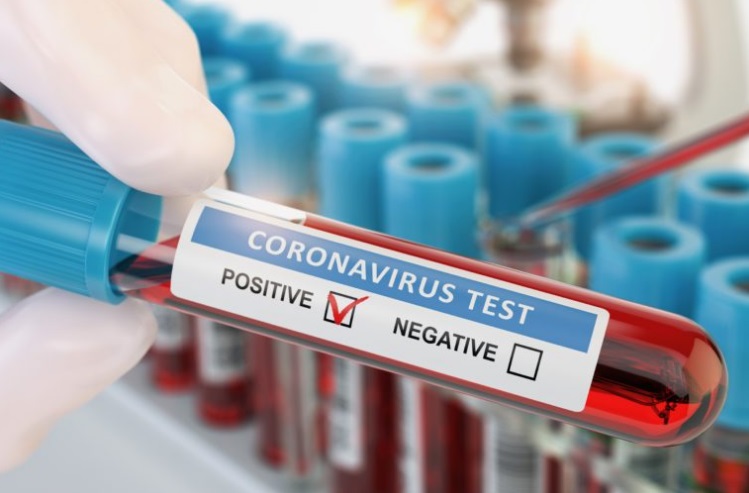 N.C registró 1.310 casos de COVID-19 este jueves