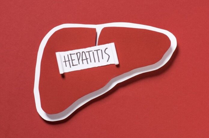 Brote de hepatitis infantil en Estados Unidos