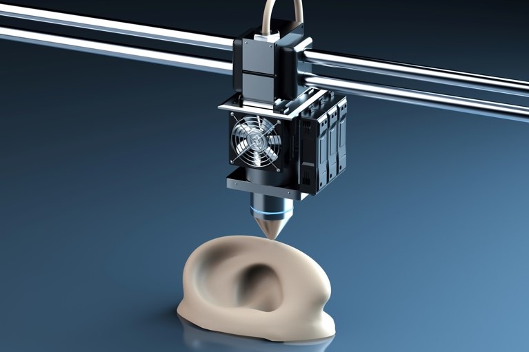 Hispana recibe primer trasplante de oreja 3D