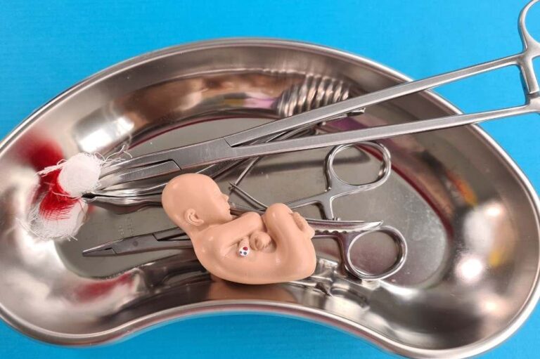 Supremo de Estados Unidos eliminó el derecho al aborto ¿qué viene ahora?