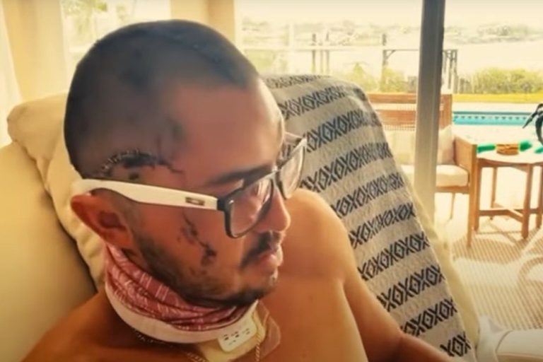 Hispano sufrió brutal ataque de caimán