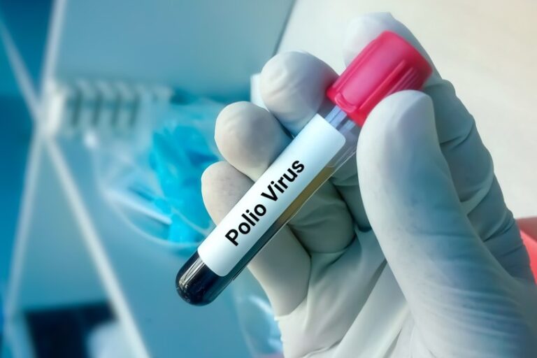 Estado de emergencia para evitar propagación de la polio