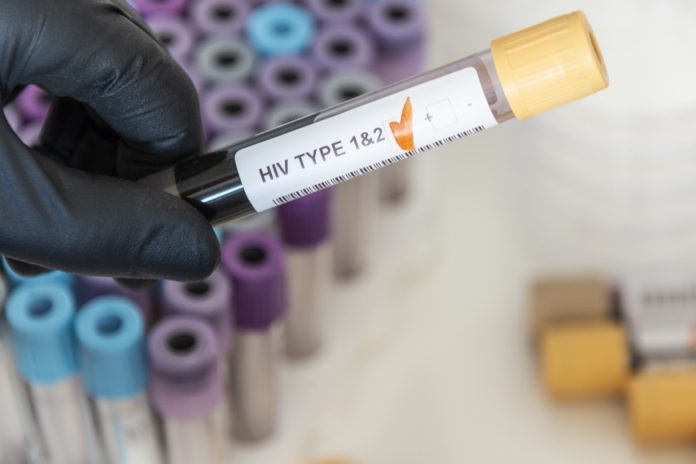 Neoyorquina es la primera mujer curada de VIH