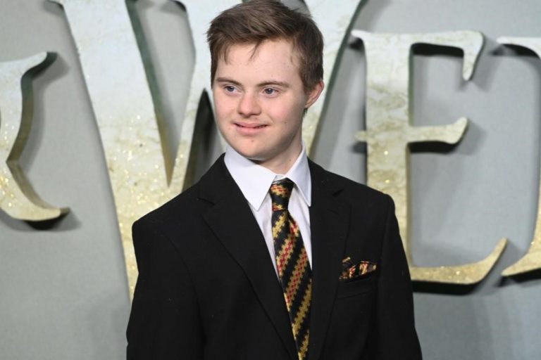 Primer actor con síndrome de Down participará en Peter Pan y Wendy