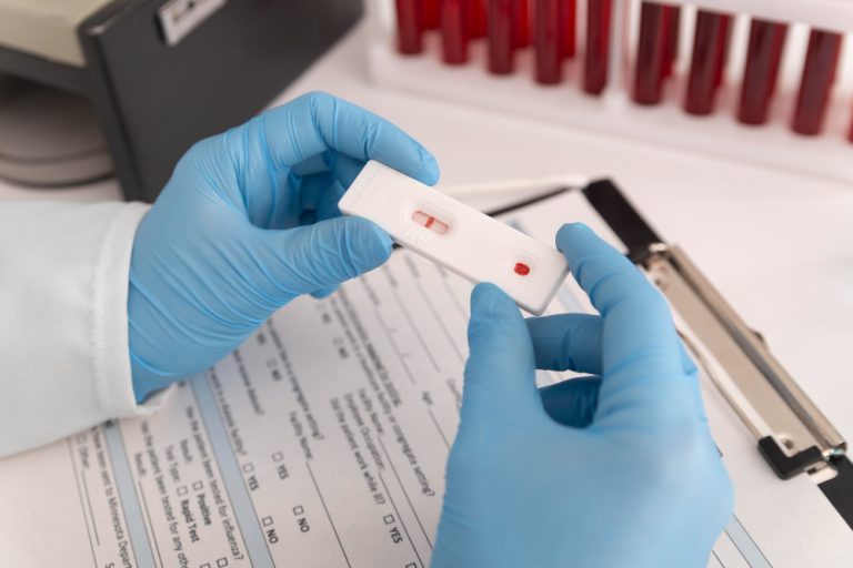 La FDA aprueba la autoprueba de VIH más rápida