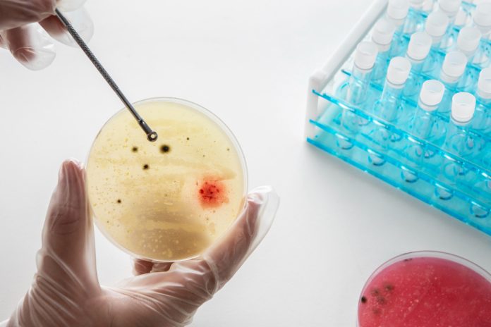 OMS: La gonorrea se vuelve cada vez más resistente a los antibióticos