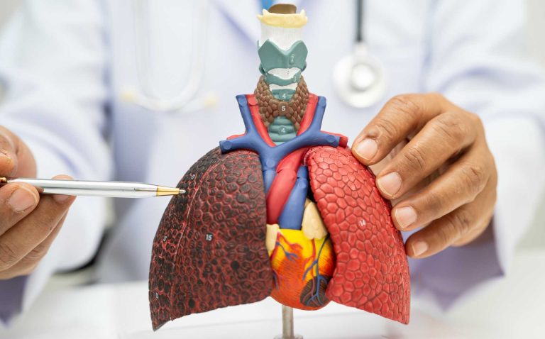 Estiman que 480 residentes de NC mueren cada año por cáncer de pulmón por el radón