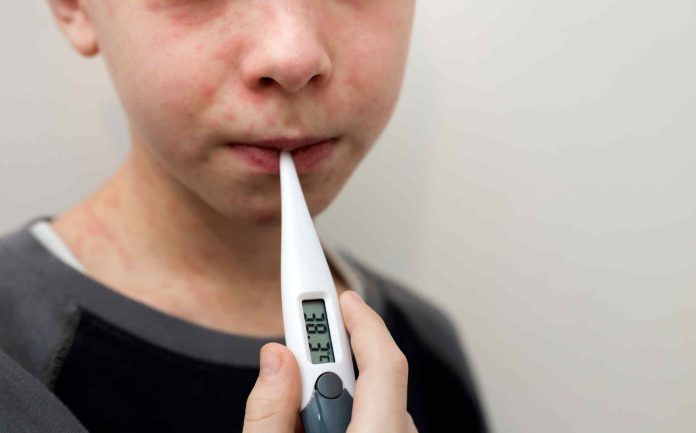 Se reporta el tercer caso de sarampión en Mecklenburg County