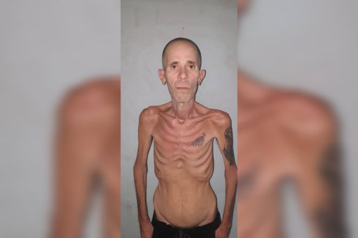 Cuba excarcela a preso político con cáncer avanzado y desnutrición